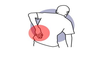 Gençlerde Bel Fıtığı ve Bel Fıtığı Ameliyatı